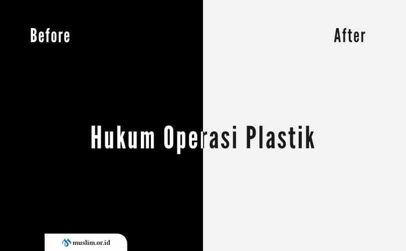 Hukum Operasi Plastik Untuk Kecantikan